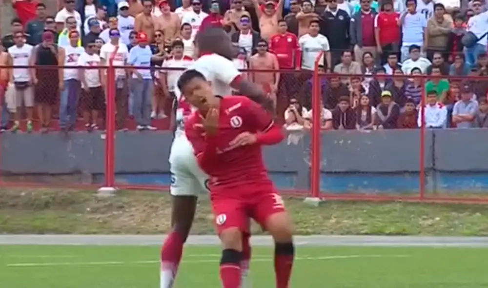 Osorio sufrió un codazo en el rostro durante el partido entre Universitario y UTC. | Foto: Gol Perú Osorio sufrió un codazo en el rostro durante el partido entre Universitario y UTC. | Foto: Gol Perú