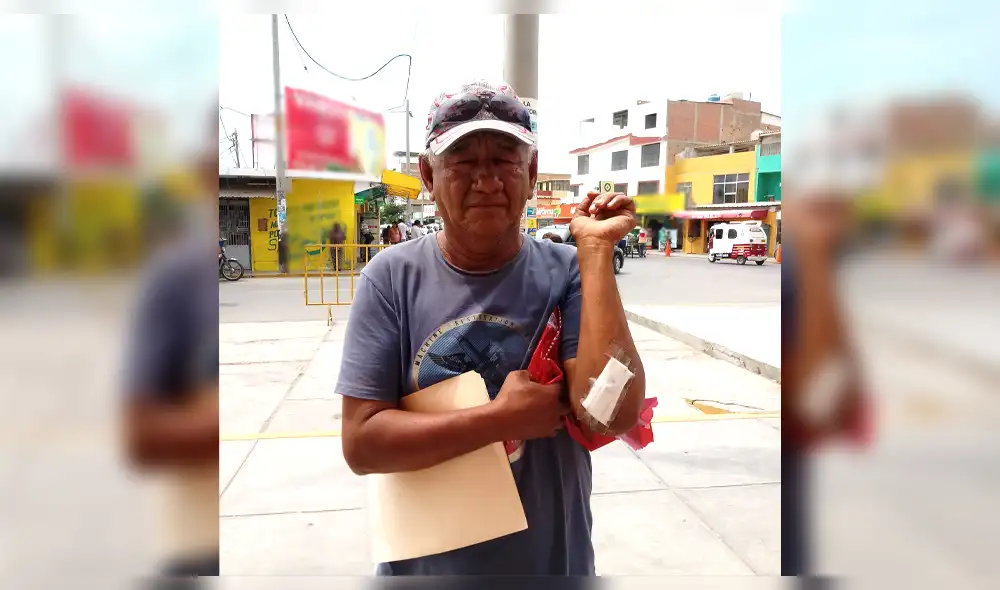 Mototaxista aun presenta lesiones tras el accidente. Mototaxista aun presenta lesiones tras el accidente.