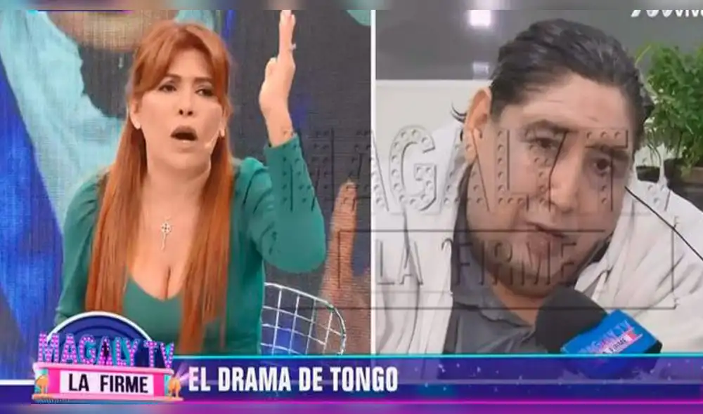 Gerente de seguro afirma que Tongo sí tiene SIS para tratamiento que necesita