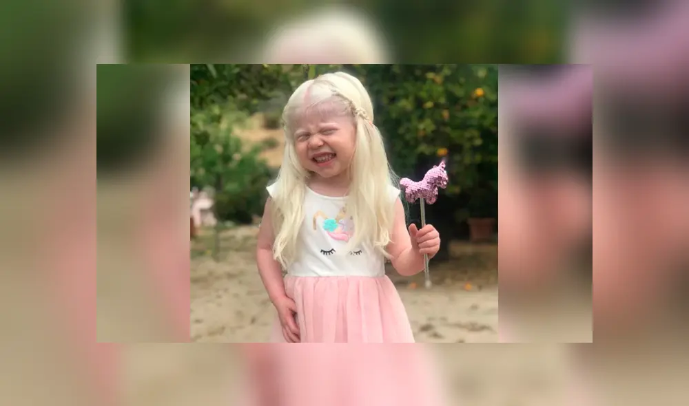 Hombre duda sobre la paternidad de su hija y descubre que la menor era albina Hombre duda sobre la paternidad de su hija y descubre que la menor era albina