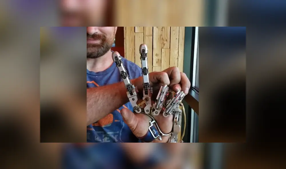El hombre decidió hacerse una prótesis para la mano luego de que le amputaran cuatro dedos. Foto: Instagram El hombre decidió hacerse una prótesis para la mano luego de que le amputaran cuatro dedos. Foto: Instagram