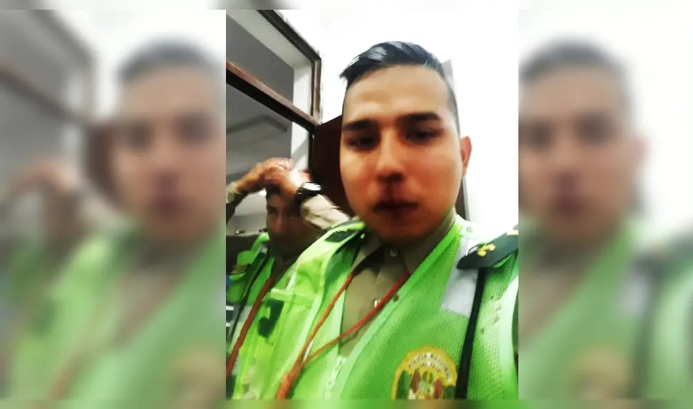 Efectivo muestra las lesiones ocasionadas en el rostro.