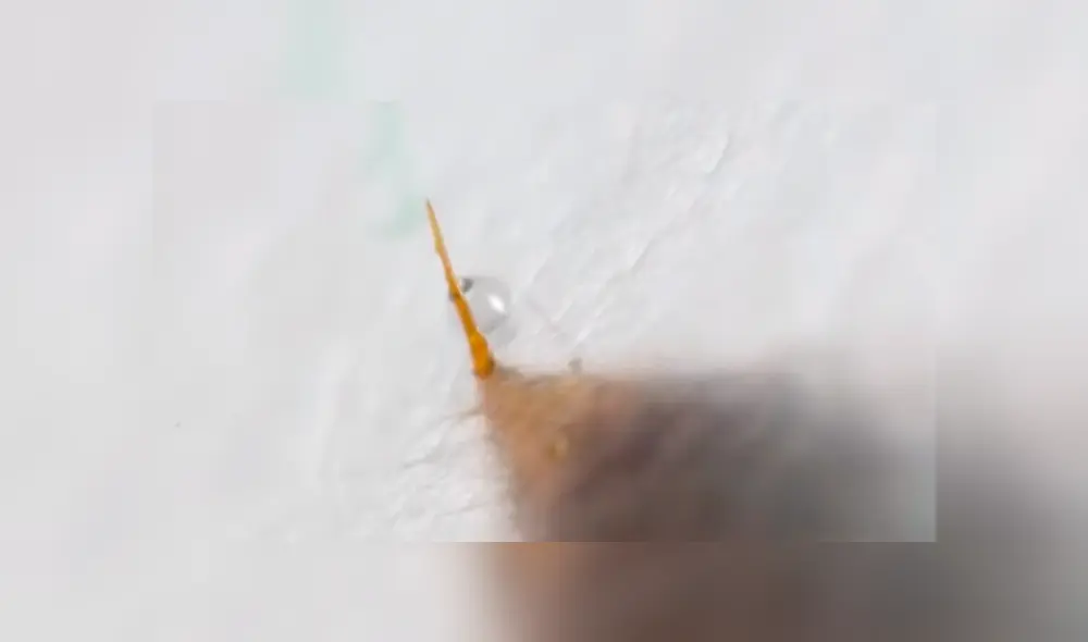 La mordedura de hormiga no es la que duele sino su letal aguijón. Foto: captura