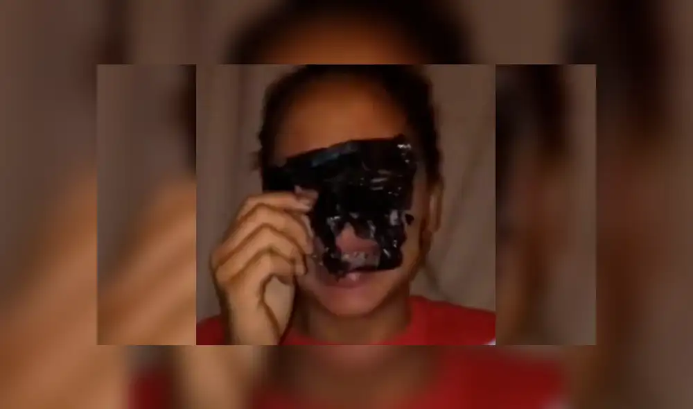 Facebook: muchacha asiática deseaba lucir como estrella K-Pop y se termina 'desfigurando' el rostro