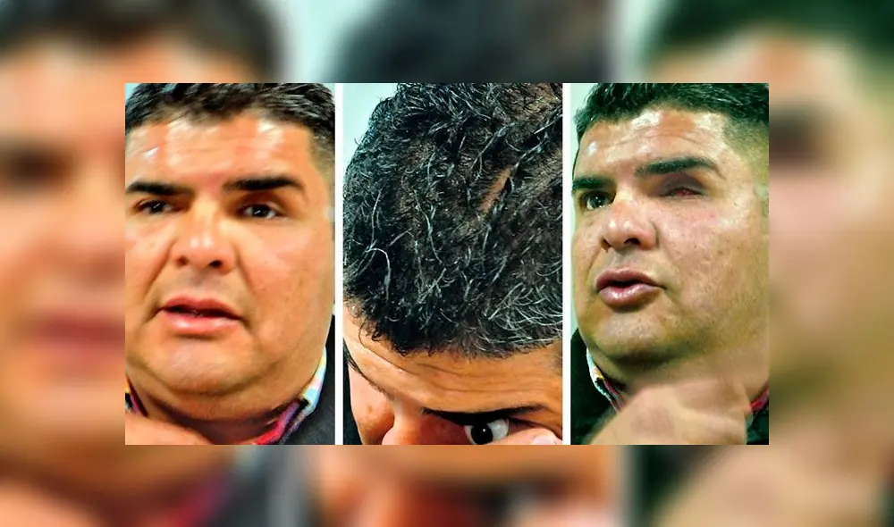 Hombre se sacó un ojo en pleno juicio para demostrar la agresión que sufrió [FOTOS]