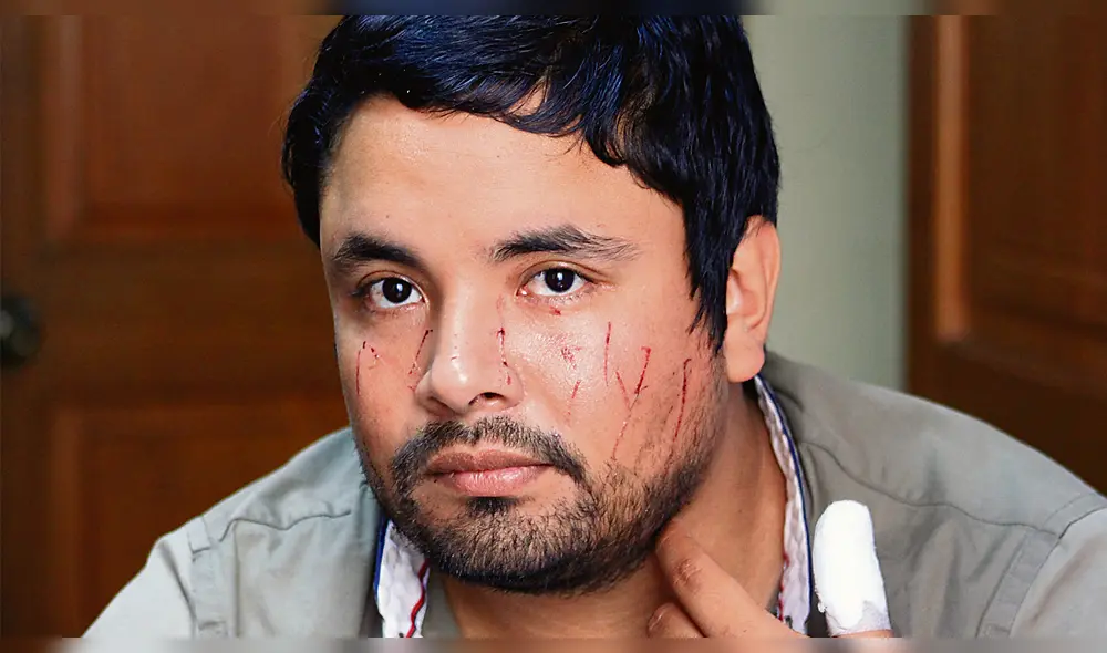 LESIONES GRAVES. Víctima resultó con 26 rasguños en el rostro y el dedo pulgar de la mano cortado con una botella rota.