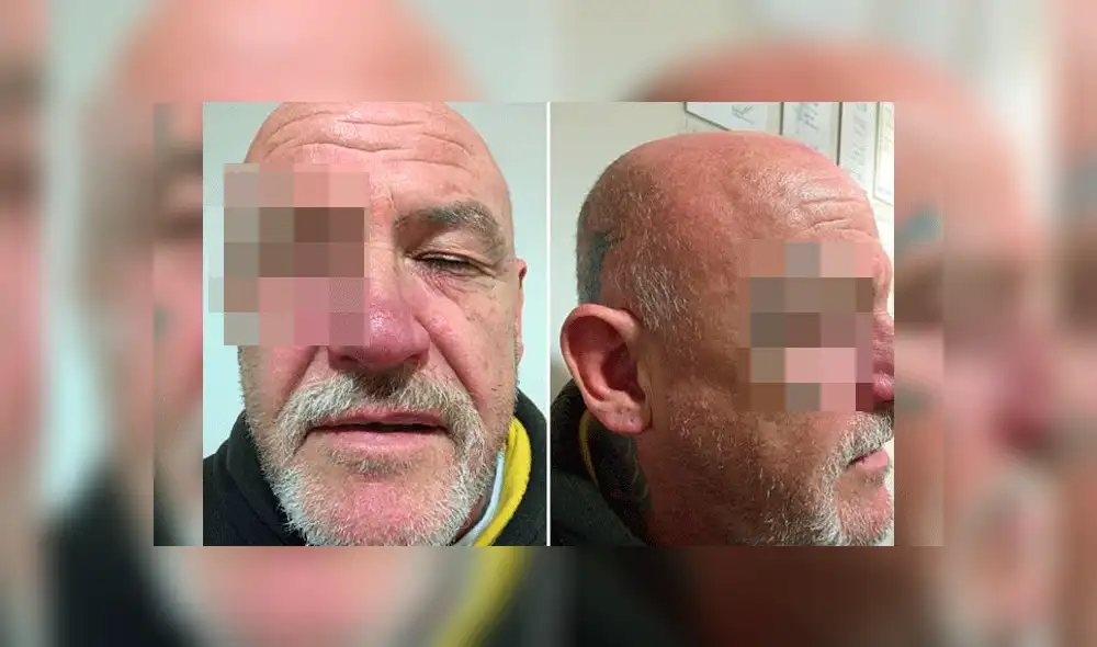 Facebook: Se fue de fiesta con sus amigos y regresó con algo horrible en el rostro [FOTOS]