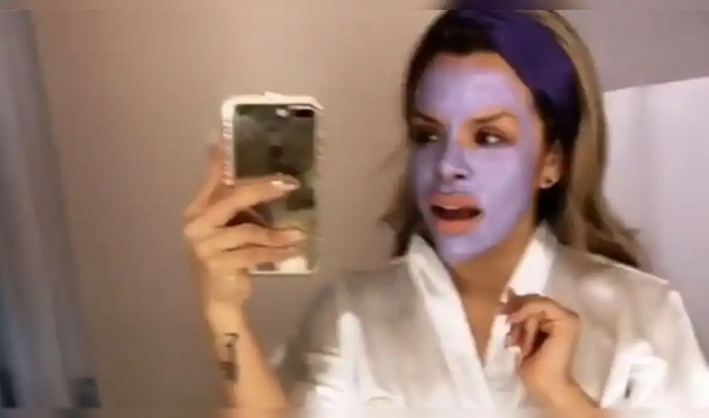 Josetty Hurtado se aplica bótox y el resultado asombra a sus fans [VIDEO]