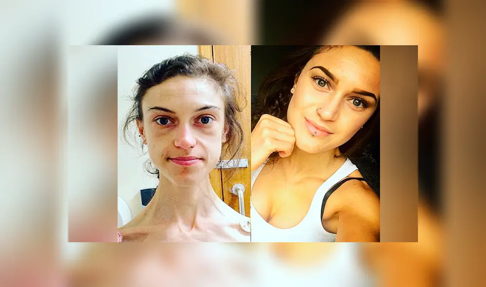 En Instagram, joven vence anorexia y su radical cambio sorprende a miles [FOTOS]