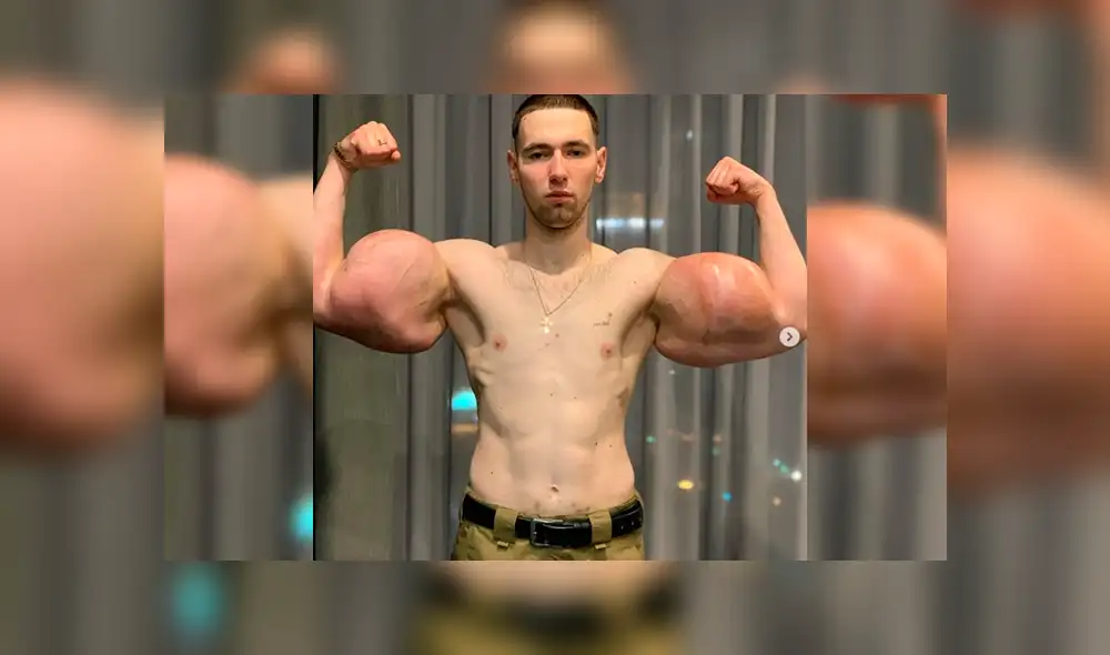 Fisiculturista de Rusia Fisiculturista de Rusia