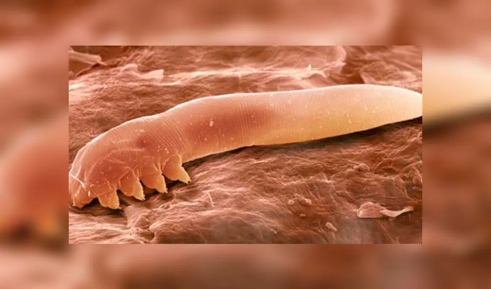 Demodex:  el ácaro que vive y se reproduce en el rostro ¿es una amenaza?