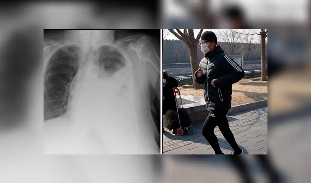 Zhang Ping salía a correr todos los días  con la mascarilla puesta, pero esta práctica le trajo serios problemas.