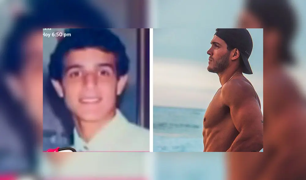 Mario Irivarren confiesa a cuántas cirugías se sometió para mejorar su imagen