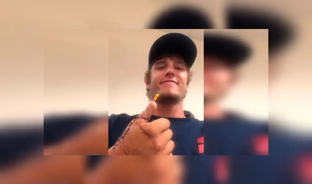 Cirujanos extirpan dedo del pie a paciente para reemplazar el pulgar de su mano [FOTOS]