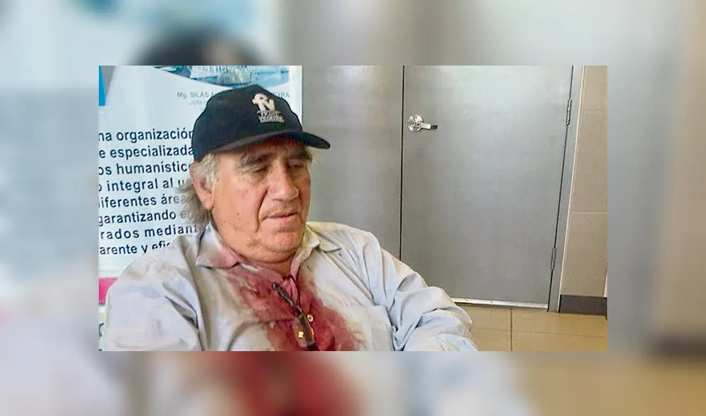 Herido. Agredido en una marcha en el interior del país. Crédito José Carlos Zanelli