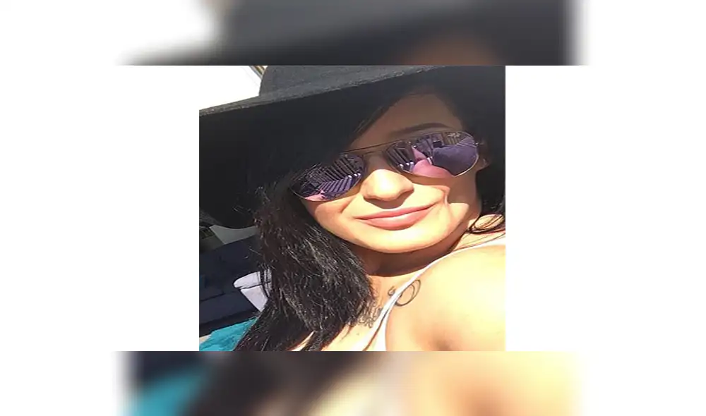 Rara enfermedad obligó a mujer a reconstruirse el rostro con grasa de su estómago 