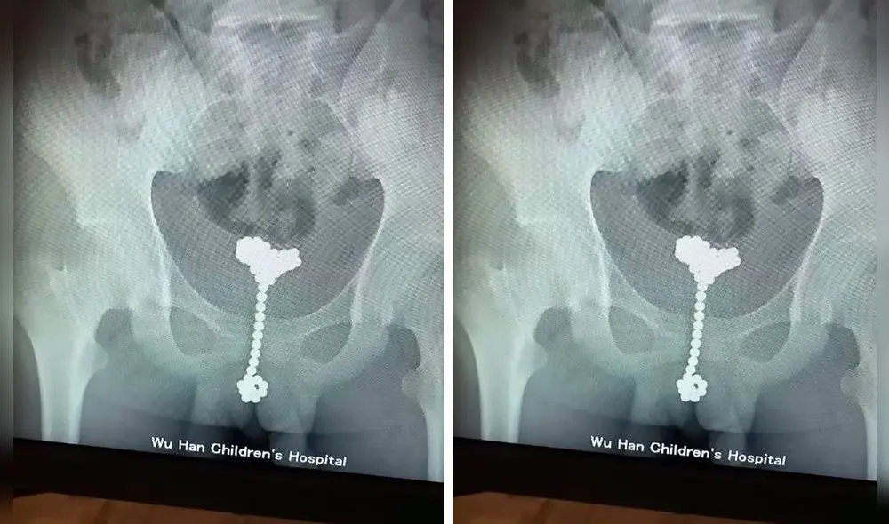 El Hospital de Niños de Wuhan en la provincia de Hubei, China, tuvo recientemente un caso insólito. Foto: Difusión.