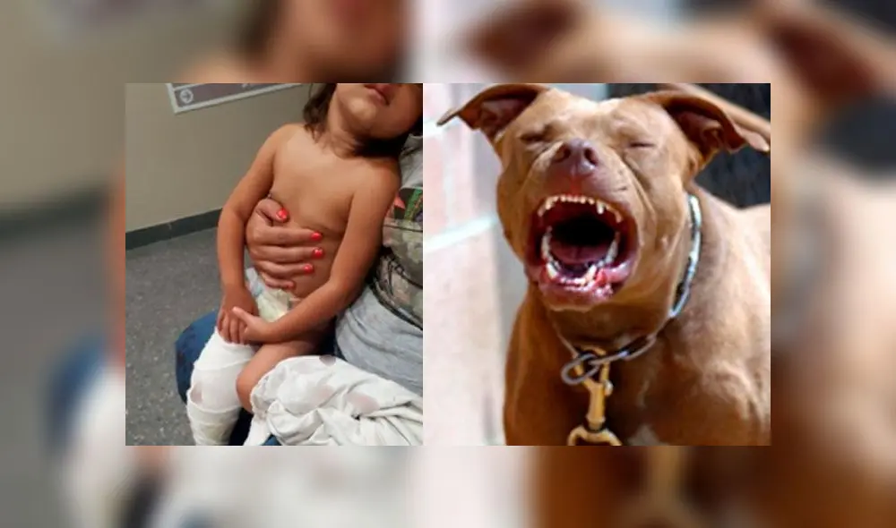 Los médicos aún no saben si volverá a caminar bien.