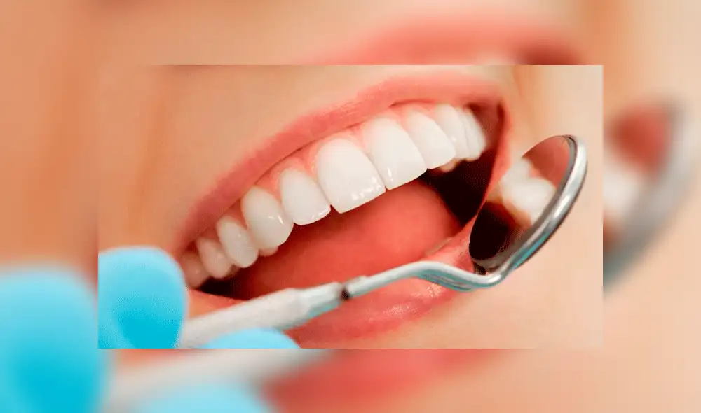 Facebook: A una mujer le creció un diente en la nariz [FOTO]