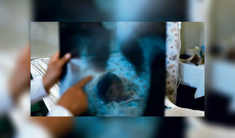 En 2018 fallecieron 28.