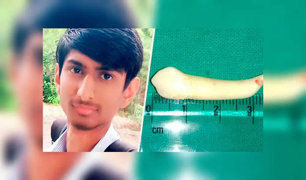 Pawan Bhavsar, fue al dentista porque sufría de hinchazón en las encías, ampollas en la boca y dolor en la mandíbula y ojos. (Foto: Difusión)