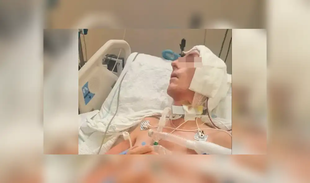 Hombre fue golpeado con un bate de béisbol en la cabeza durante un robo Hombre fue golpeado con un bate de béisbol en la cabeza durante un robo