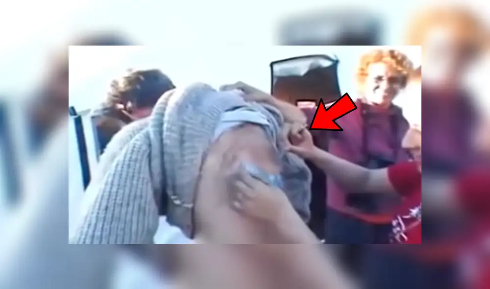 Facebook viral: misteriosas criaturas vivían dentro de la espalda de un joven sin que él lo sepa [VIDEO]