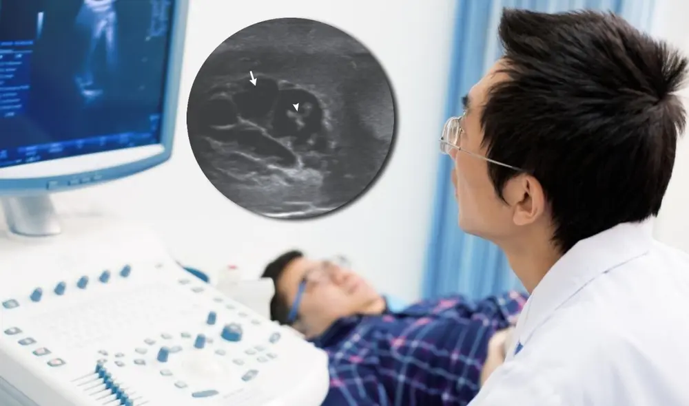 El paciente, un joven de 26 años que vivía en Nueva Delhi (India), había asistido al médico por un dolor e hinchazón en los testículos que padeció durante casi un mes. Foto: composición de La República / Medical News Today. El paciente, un joven de 26 años que vivía en Nueva Delhi (India), había asistido al médico por un dolor e hinchazón en los testículos que padeció durante casi un mes. Foto: composición de La República / Medical News Today.