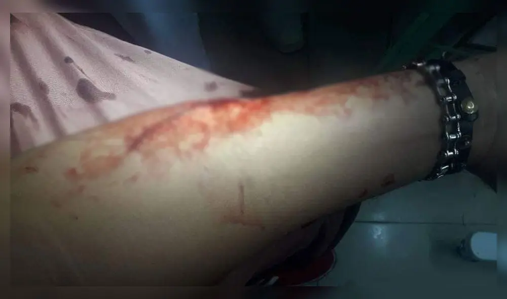 Chiclayo: agreden a activista en el interior de discoteca 