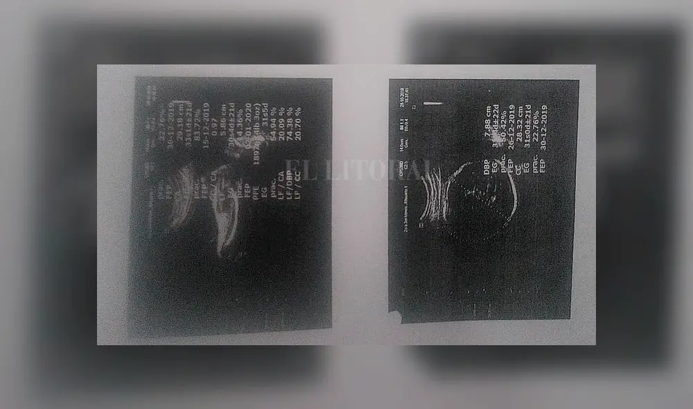 Mujer da a luz a un bebé con dos cabezas y los doctores no se dieron cuenta Mujer da a luz a un bebé con dos cabezas y los doctores no se dieron cuenta