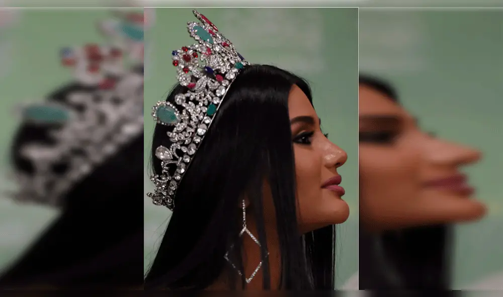 Filtran inéditas imágenes de Miss Venezuela antes de operaciones en el rostro