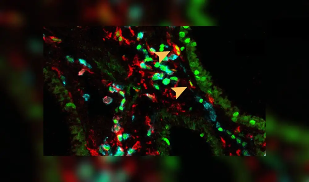 Las flechas naranjas indican la presencia de las células NAM en el pulmón. Crédito: Science Immunology.