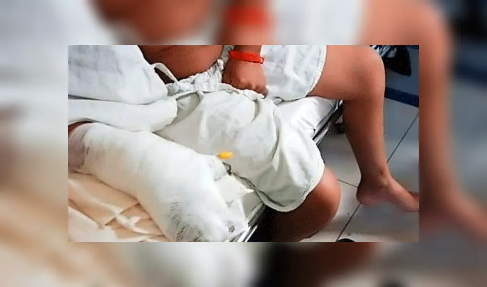 Niños resultaron quemados. Niños resultaron quemados.