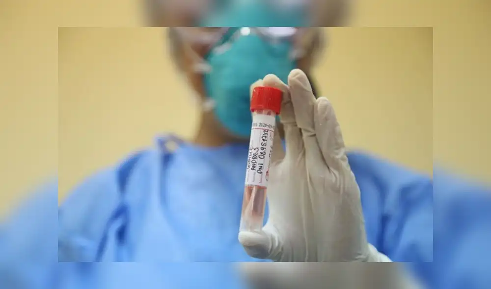 Diresa de Loreto. Créditos: Andina Diresa de Loreto. Créditos: Andina