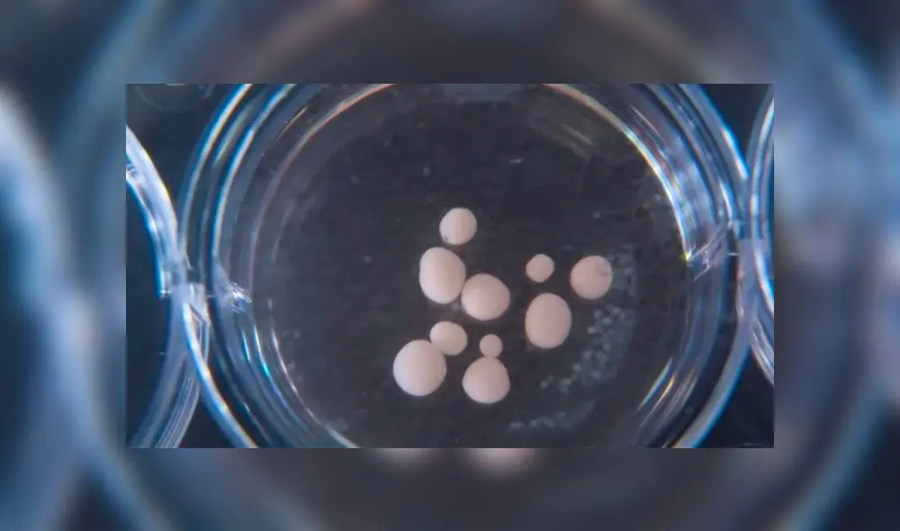 Los minicerebros creados en el laboratorio miden aproximadamente medio centímetro. Foto: Universidad de California San Diego. Los minicerebros creados en el laboratorio miden aproximadamente medio centímetro. Foto: Universidad de California San Diego.