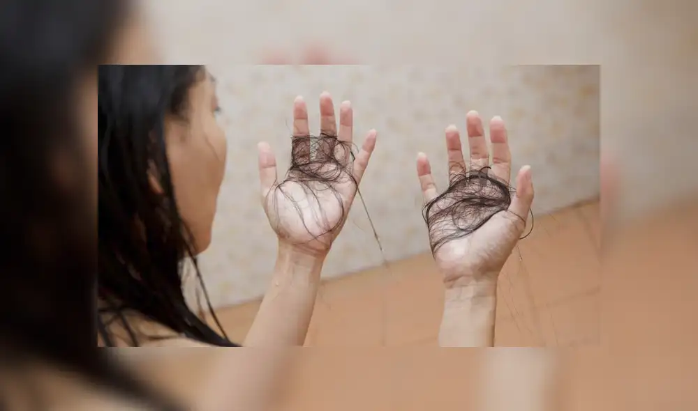 Los pacientes recuperados de coronavirus pueden sufrir efluvio telógeno, una condición que hace que el cabello deje de crecer en los próximos tres meses. Foto: SHUTTERSTOCK / referencial Los pacientes recuperados de coronavirus pueden sufrir efluvio telógeno, una condición que hace que el cabello deje de crecer en los próximos tres meses. Foto: SHUTTERSTOCK / referencial