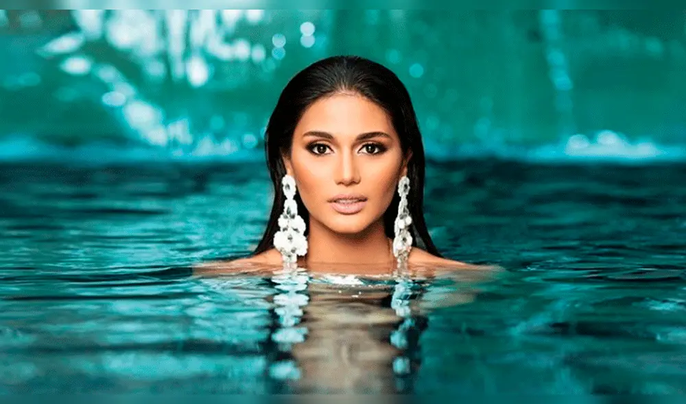 Filtran inéditas imágenes de Miss Venezuela antes de operaciones en el rostro