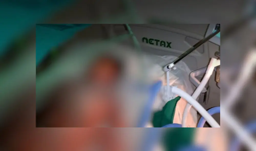 Menor de 11 años sufrió accidente mientras sus padres preparaban chancaca. (Foto: Facebook Hospital Santa Rosa de Piura)