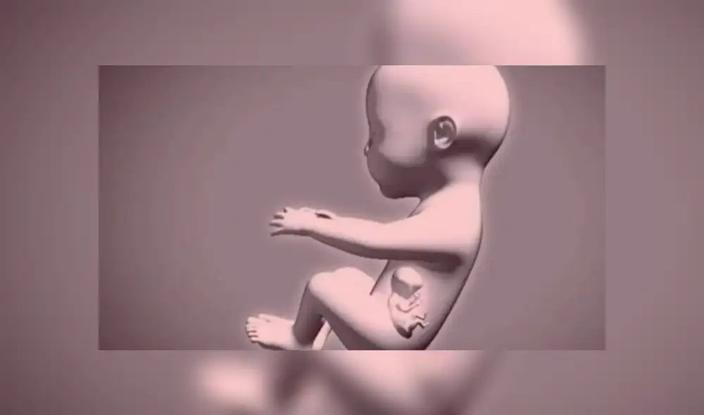 Bebé nace 'embarazada' de su propio gemelo y asusta al mundo [FOTOS]