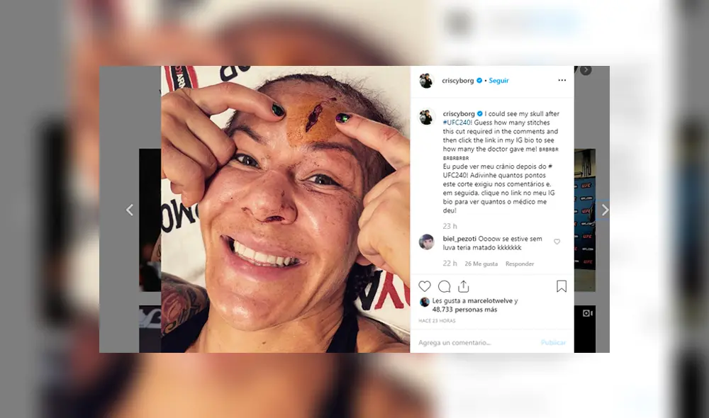 Cris Cyborg le ganó a Felicia Spencer en un duelo de UFC, pero sufrió un impactante corte en la frente.