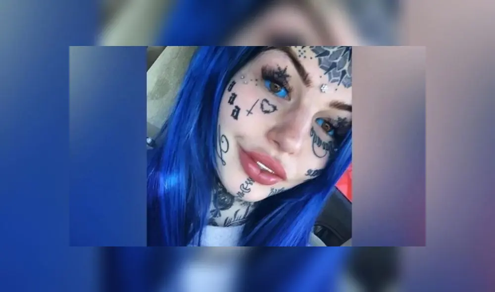 La joven quedó ciega por 21 días.