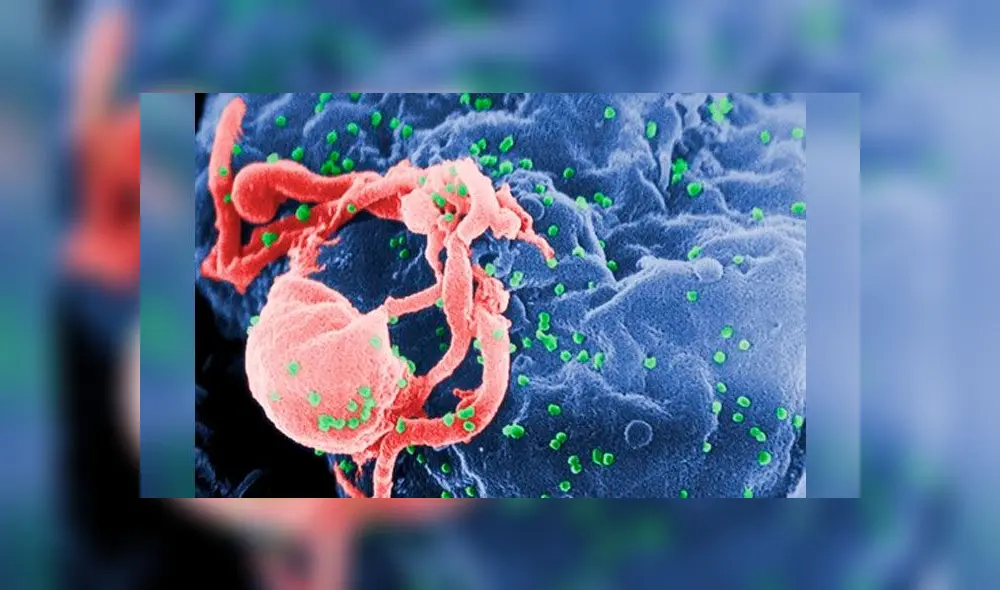 Un compuesto capaz de neutralizar al virus de la inmunodeficiencia humana (VIH). Imagen referencial: célula infectada. Un compuesto capaz de neutralizar al virus de la inmunodeficiencia humana (VIH). Imagen referencial: célula infectada.