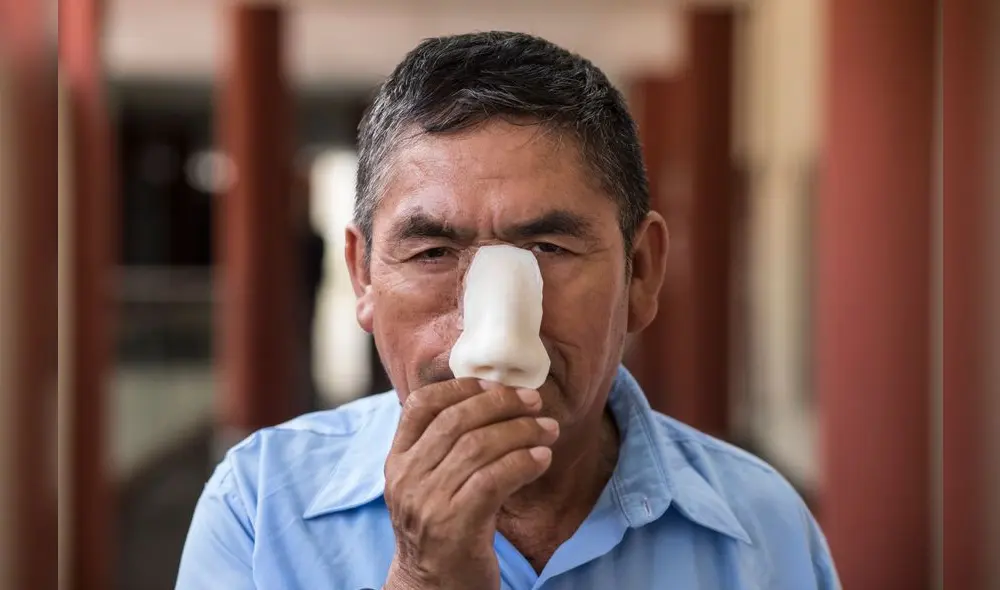 28.02.2020 ALDAIR MEJIA TEMA RECONSTRUCCION FACIAL EN LA UNI CETIC 