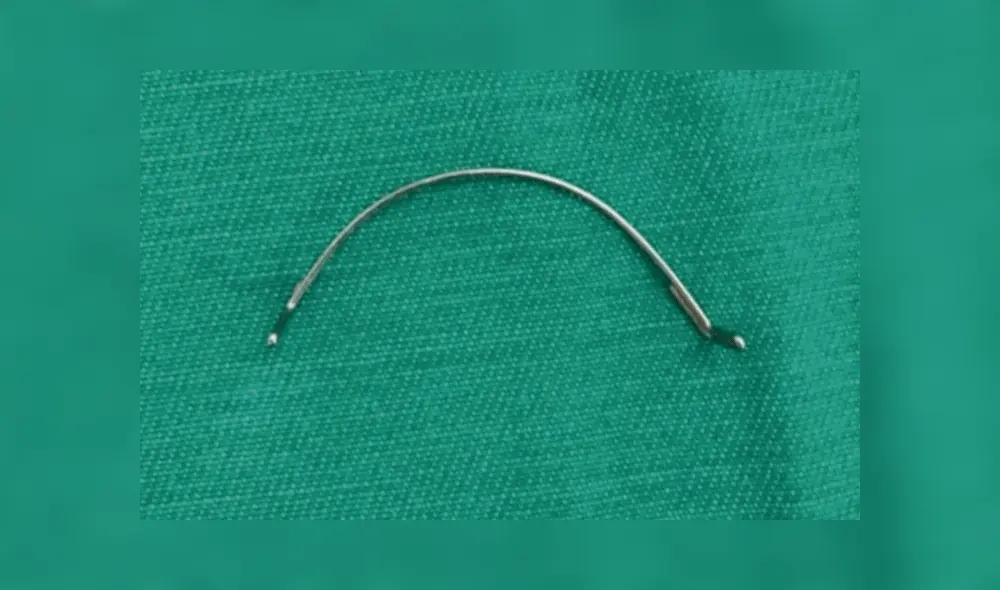 Adolescente se perfora la garganta al ingerir parte de sus brackets y sobrevive [FOTOS]