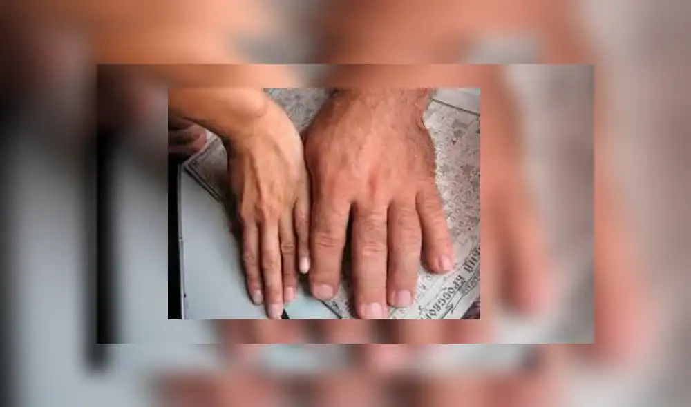 El extraño caso del hombre con la cabeza en forma de cerebro