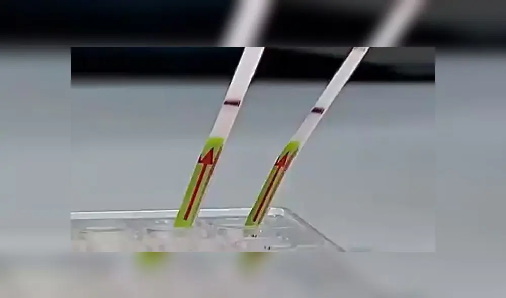 Pruebas rápidas moleculares. Créditos: Twitter de Eduardo Málaga Trillo