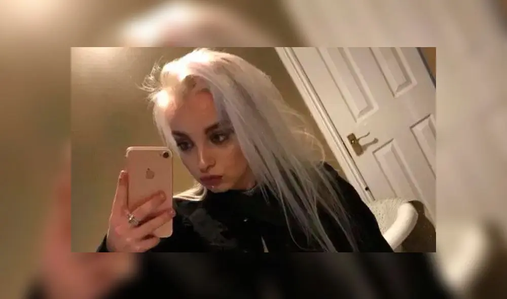 Embarazada es agredida por dos jóvenes mientras esperaba en el paradero Embarazada es agredida por dos jóvenes mientras esperaba en el paradero