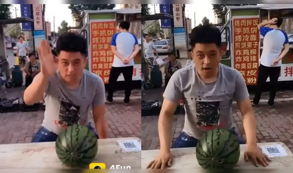 YouTube Viral: En el hospital terminó joven que quiso romper sandía con la cabeza [VIDEO]