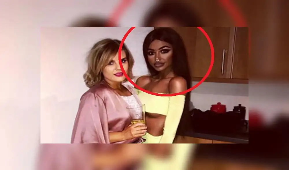 Joven se inyecta fármaco tres veces por semana para oscurecer su piel  [FOTOS]