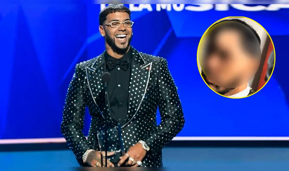 Anuel AA expone calvicie a fans tras 'accidente' en Instagram [VIDEO]